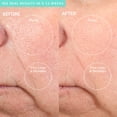 thumbnail image 4 of Máquina de microdermoabrasión PMD Beauty Personal Microderm Pro, 4 of 8