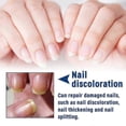 thumbnail image 3 of Formula Fungal Nail Paronychia Treatment Gel, Toenail Fungus Treatment, Extra Strength Nail Repair Solution For Finge, 3 of 5