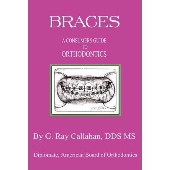 Braces: A Consumers Guide to Orthodontics, (Paperback)