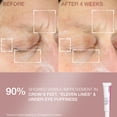 thumbnail image 5 of Set de crema hidratante para la piel StriVectin SD Advanced Plus de 59 ml, 5 of 5