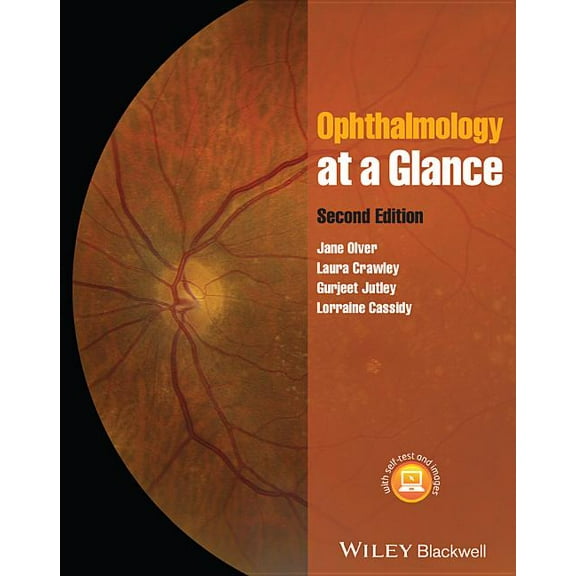 At a Glance: Ophthalmology at a Glance (Paperback)