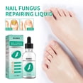 thumbnail image 3 of Aceite de hongo para uñas de los pies líquido reparador de uñas para blanquear las uñas cuidado de los pies, 3 of 9