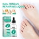 thumbnail image 1 of 30ml Toenail Fungus Oil Nail Care Repair Liquid para blanqueamiento antihongos Ndcxsfigh  Nuevos Originales, 1 of 9