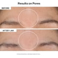 thumbnail image 3 of Almohadillas faciales exfoliantes StriVectin Advanced Resurfacing 60 unidades, 3 of 9