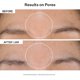 thumbnail image 3 of Almohadillas faciales exfoliantes StriVectin Advanced Resurfacing 60 unidades, 3 of 9