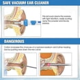 thumbnail image 2 of Ear Cleaner, Ear Wax Remover, Ear Wax Cleaner, Electric Ear Cleaner, Ear Wax, 2 of 5