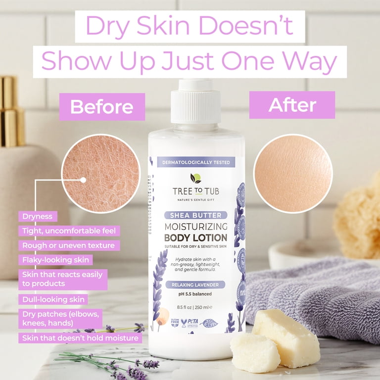 Tree To Tub Lavender Shea Butter Body Lotion for Dry Skin photo 4