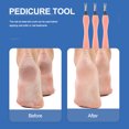 thumbnail image 4 of HOOWIFFY 5Pcs Cuticle Remover Tool Metal For Rough Skin Scraper In Nail Art, 4 of 8