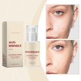 thumbnail image 2 of (Liposoma Retinal 2% + Ginseng Negro) Suero Antiarrugas Rápido para Reducir Arrugas, Manchas Oscuras y Daños Solares, Tensar y Levantar el Rostro - 30 ml / 1 fl oz, 2 of 9