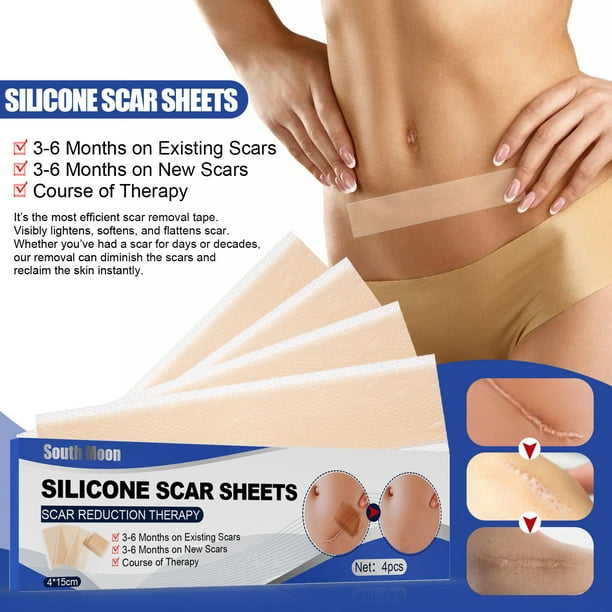1 caja de hojas de silicona para cicatrices, hoja de Gel para el cuidado de Cica, cinta para eliminar cicatrices, pegatina para cicatrices para cirugía, heridas, quemaduras, cicatrices de acné TUNC Sencillez
