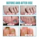 thumbnail image 2 of Esencia De Eliminación De Hongos En Las Uñas Solución De Reparación De Uñas Gris Paronychia Nail Fungus Care Liquid Care Essence Liquid Ndcxsfigh  Cuidado Belleza, 2 of 3