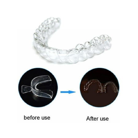 Moldable teeth whitening trays walmart