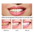 thumbnail image 4 of Líquido Limpiador de Manchas Dentales 10 Ml | Elimina Manchas de Té | Cuidado Bucal Suave | 1 Limpiador + 10 Bastoncillos, 4 of 5