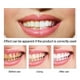 thumbnail image 4 of Cleansing Liquid To Yellow Teeth And Tea Stains 10ml, 4 of 5