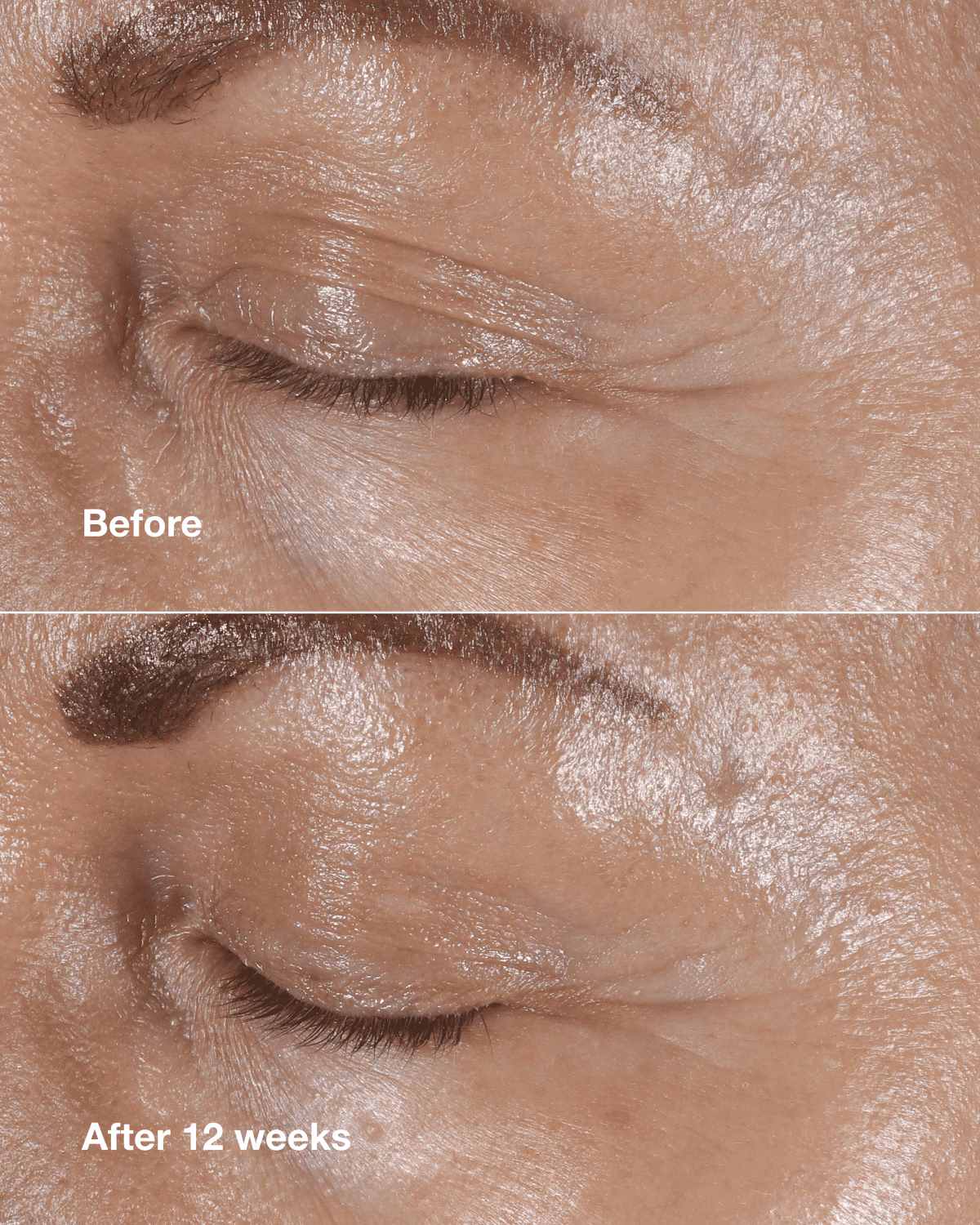 thumbnail image 2 of Clinique Smart Clinical Repair Wrinkle Correcting Eye Cream 0.5oz/15ml, 2 of 5