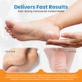 thumbnail image 6 of activelife - Revitaderm 4D Urea Foot Cream, Deeply Moisturizes for Dry, Cracked Feet, Hands, Elbows and Knees, Ultra Repair Cream and Callus Remover For Feet, Free Pumice Stone Included, 4oz, 10 Pack, 6 of 8