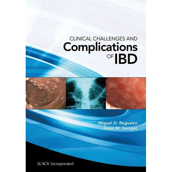 Clinical Challenges and Complications of IBD (Paperback)