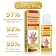 thumbnail image 4 of Aceite de Quiebra de Acantosis nigricans, no Grasiento Iluminan El Tono de la Piel Acantasis Nigricans Aceite 3 piezas de 50 ml para tobillos, 4 of 7