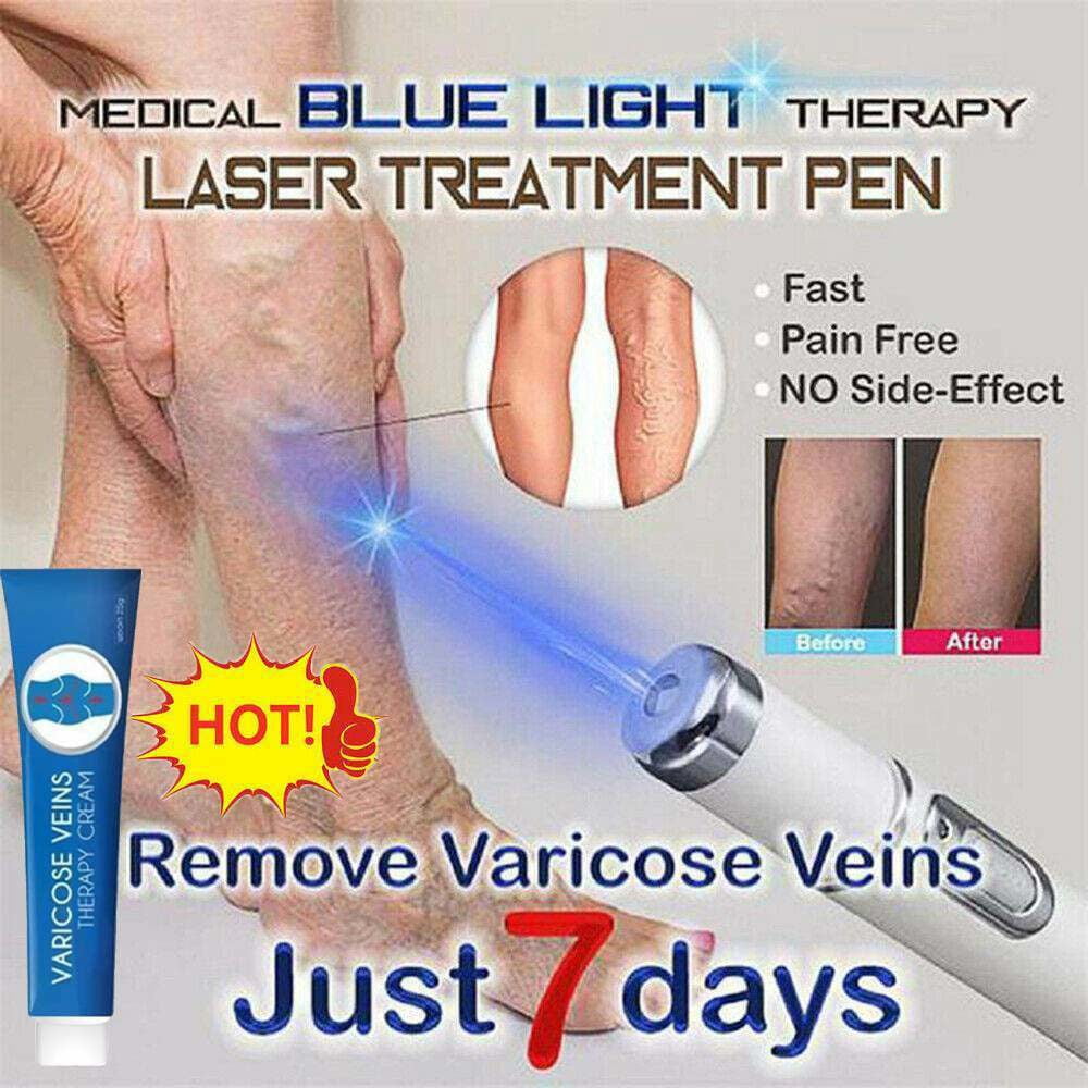 Blue Light Therapy Varicose Veins Pen/Cream - Soft Removal Set - Walmart.com