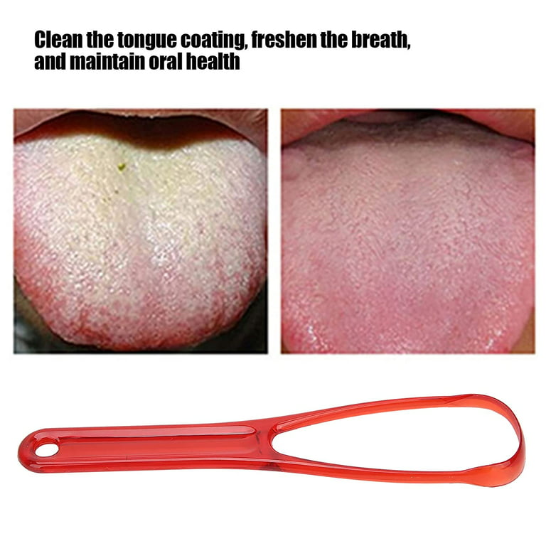Plastic Tongue Scraper, Travel Portable Freshen Breath Tongue Brush Cleaner  for Oral Care
