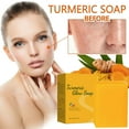 thumbnail image 1 of Fiudx Jabón de Cúrcuma, Limpiador Facial Iluminador, Barra Corporal para Unificar El Tono, Jabón con Infusión de Limón, Ideal para La Ducha Facial y Corporal, Apto para Pieles Sensibles, Doble Efecto, 1 of 7