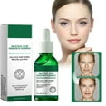 intensive-care-for-repairing-pore-specially-formulated-with-salicylic