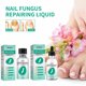 thumbnail image 3 of Cuidado de las uñas aceite esencial, Yanshi solución reparadora de queratina 30ml tratamiento uñas hongo unisex Yanshi Cuidado de las uñas aceite esencial, 3 of 6