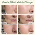 thumbnail image 5 of SAISZE Vitamin C Serum Kit – Anti-Aging Retinol & Vitamin C & Hyaluronic Acid Face Serum Set for Firming & Hydrating, Day & Night Skin Care, Mother’s Day Gift Sets for Her, 5 of 11