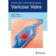 Varicose Veins: Practical Guides in Interventional Radiology (Hardcover)