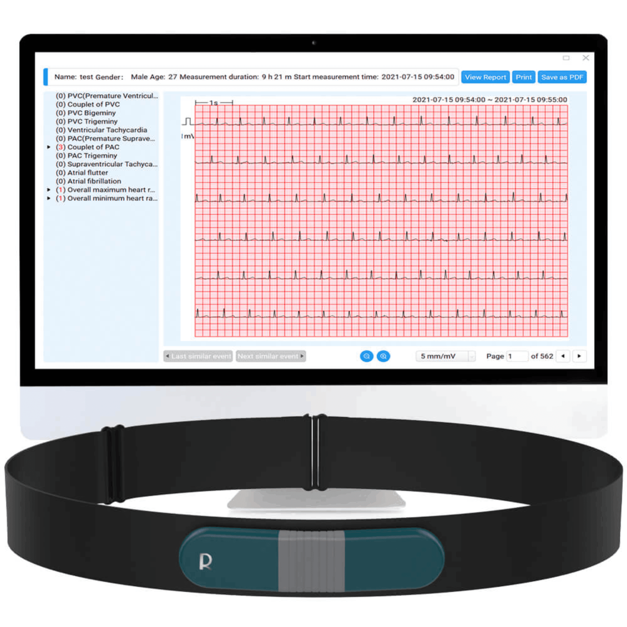Livenpace Heart Health EKG ECG Monitor,24 Hours AI ECG Monitor with Free AI Analysis and PC Report,Home EKG Heart Health Recorder, HHM1