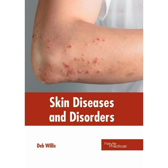 Skin Diseases and Disorders, (Hardcover)