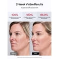 thumbnail image 3 of Dispositivo de tonificación facial JMOON NouvelleSkin M30U PR con luz roja, 3 of 8