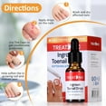 thumbnail image 5 of Ingrown Toenail Treatment - Ingrown Toenail Pain Reliever and Softener Kit for Easy Trimming with Silicone Gel Toe Caps, 5 of 7