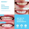 thumbnail image 2 of Tiras blanqueadoras de dientes KEIDOC, 14 tratamientos, color blanco coco, 2 of 6