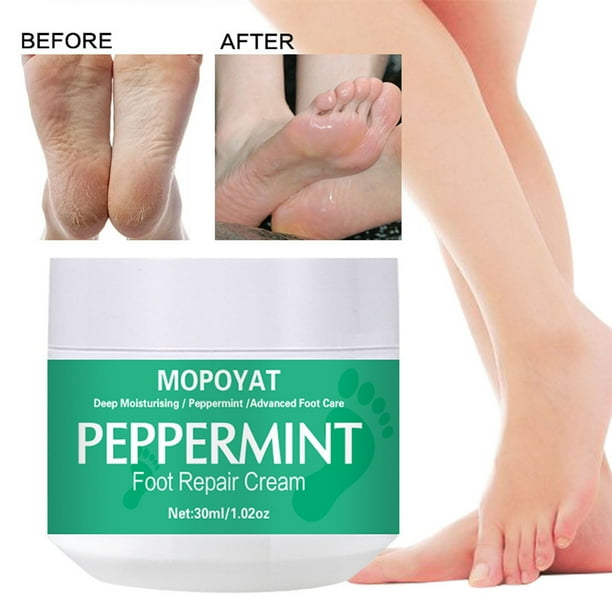 Crema de Urea Al 42 % y Ácido Salicílico Al 2 % | Crema Intensiva para Pies y Eliminador de Callos (30 G) | Hidratante con Aloe Vera y Aceite de Árbol de Té | Previene La Piel Seca y Agrietada