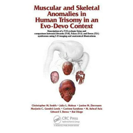 Muscular and Skeletal Anomalies in Human Trisomy in an Evo-devo Context: Description of a T18 Cyclopic Fetus and Comparison Between Edwards T18, Patau T13 and Down T21 Syndromes Using 3-d Imaging and Anatomical Illustratio