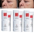 thumbnail image 2 of Crema blanqueadora de niacinamida 3 piezas, vitamina E, elimina manchas oscuras, pecas, mejora la luminosidad, ilumina rápidamente, nutre la piel Fivean unisex, 2 of 2