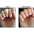 thumbnail image 4 of TIPS Nail Conditioner 3 Pack, 4 of 5