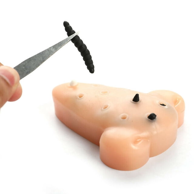 JIAHAOO Eco-Friendly Acne Squeeze Toy Soft & Elastic TPE, Perfect for Reducing Stress & Anxiety