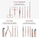 thumbnail image 2 of Manicure Set, Pedicure Kit, Nail Clippers, Professional Grooming Kit, Nail Tools 18 In 1 With Luxurious Travel Case Compatible With Men And Wo, 2 of 5