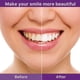 thumbnail image 4 of Pasta de dientes morada. Limpieza dental. Cuidado bucal. Pasta de dientes morada. Limpieza dental. Cuidado bucal. Pasta de dientes. 30 ml., 4 of 9