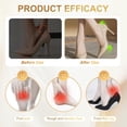 thumbnail image 3 of 2026 Upgraded Metatarsal Pads Women, Cushioned Ball of Foot Inserts, Non-Slip & Comfort Fit for High Heels, 3 of 6