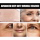 thumbnail image 4 of Teissuly Anti-Aging Serum,Advanced Deep Anti-wrinkle Serum,Reverse Signs Of Aging Such As Sunburn, Fine Lines And Wrinkles 30ML Teissuly WER202312145416, 4 of 9