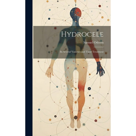 Hydrocele: Its Several Varieties and Their Treatment (Hardcover)