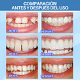 thumbnail image 4 of Perlas Reparación Dientes Postizos Dientes Gránulos Diy 30ml, 4 of 8