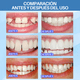 thumbnail image 4 of Perlas Reparación Dientes Postizos Dientes Gránulos Diy 30ml, 4 of 8