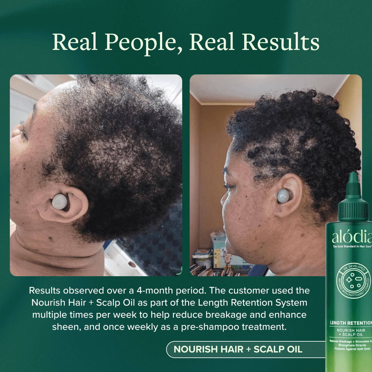 ALODIA Nourish & Grow Hair and Scalp Treatment - Avocado Oil & Rosemary Pre-Shampoo and Hot Oil for All Hair Types - 8 oz