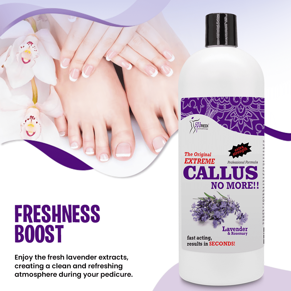 SPA REDI Callus Remover - Removes Toughest Calluses in Seconds and Smooths Dry Cracked Heels, Softens and Smooths Feet, Lavender & Rosemary - 32 Oz