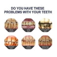 thumbnail image 4 of Tooth Paint, Tooth Polish Uptight White, Instant Whitening Paint For Teeth, 4 of 5