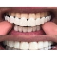 thumbnail image 2 of Upper/lower Comfort Fit Flex Whitening Denture Braces, 2 of 4